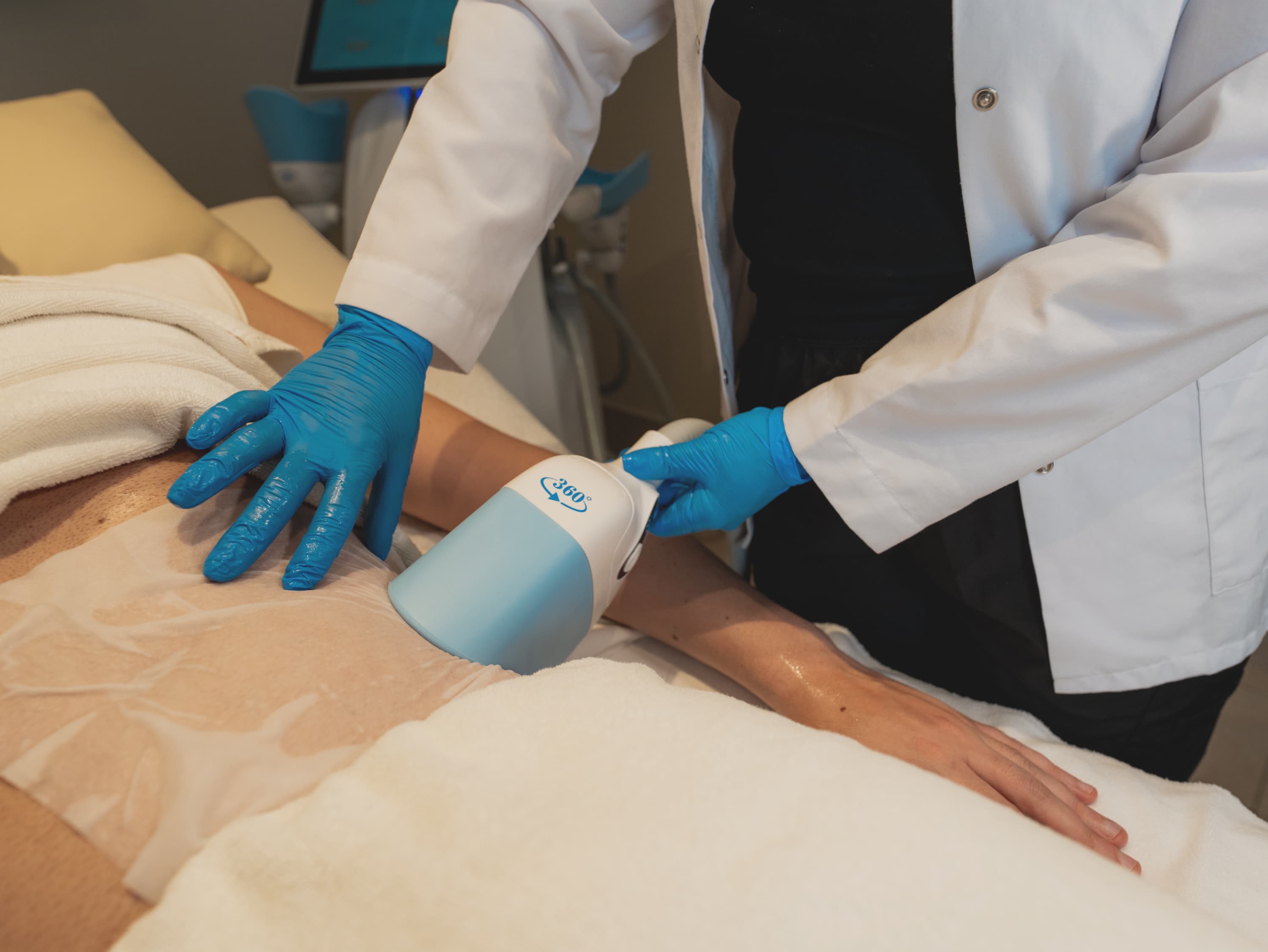 Cryolipolysis (CoolSculpting)