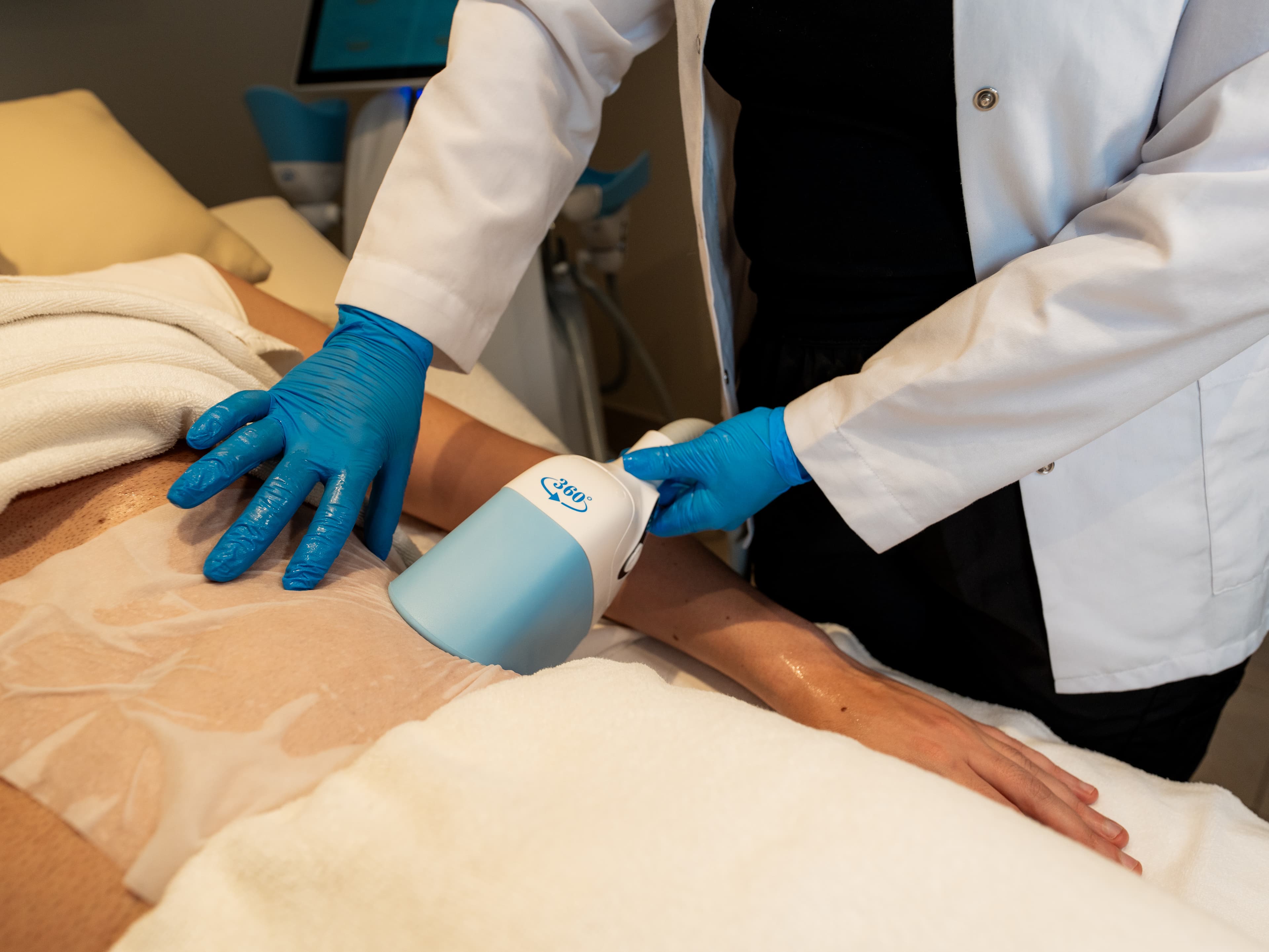 Fat Freezing in Malta treatment at Carisma Slimming in Malta