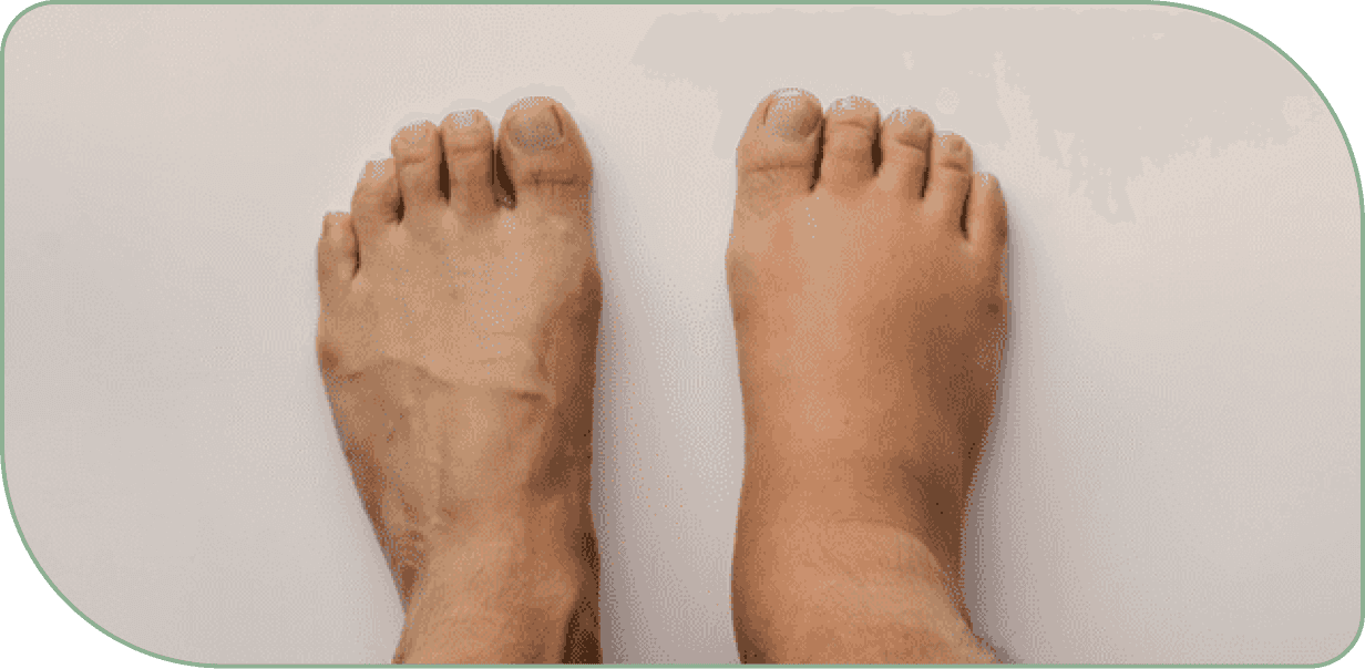 lymphatic drainage for post-procedure puffiness & recovery support evidence illustration