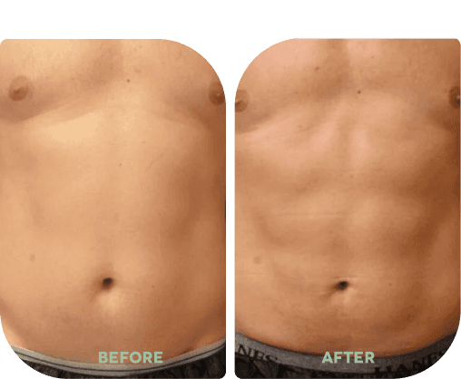 Before and after treatment result