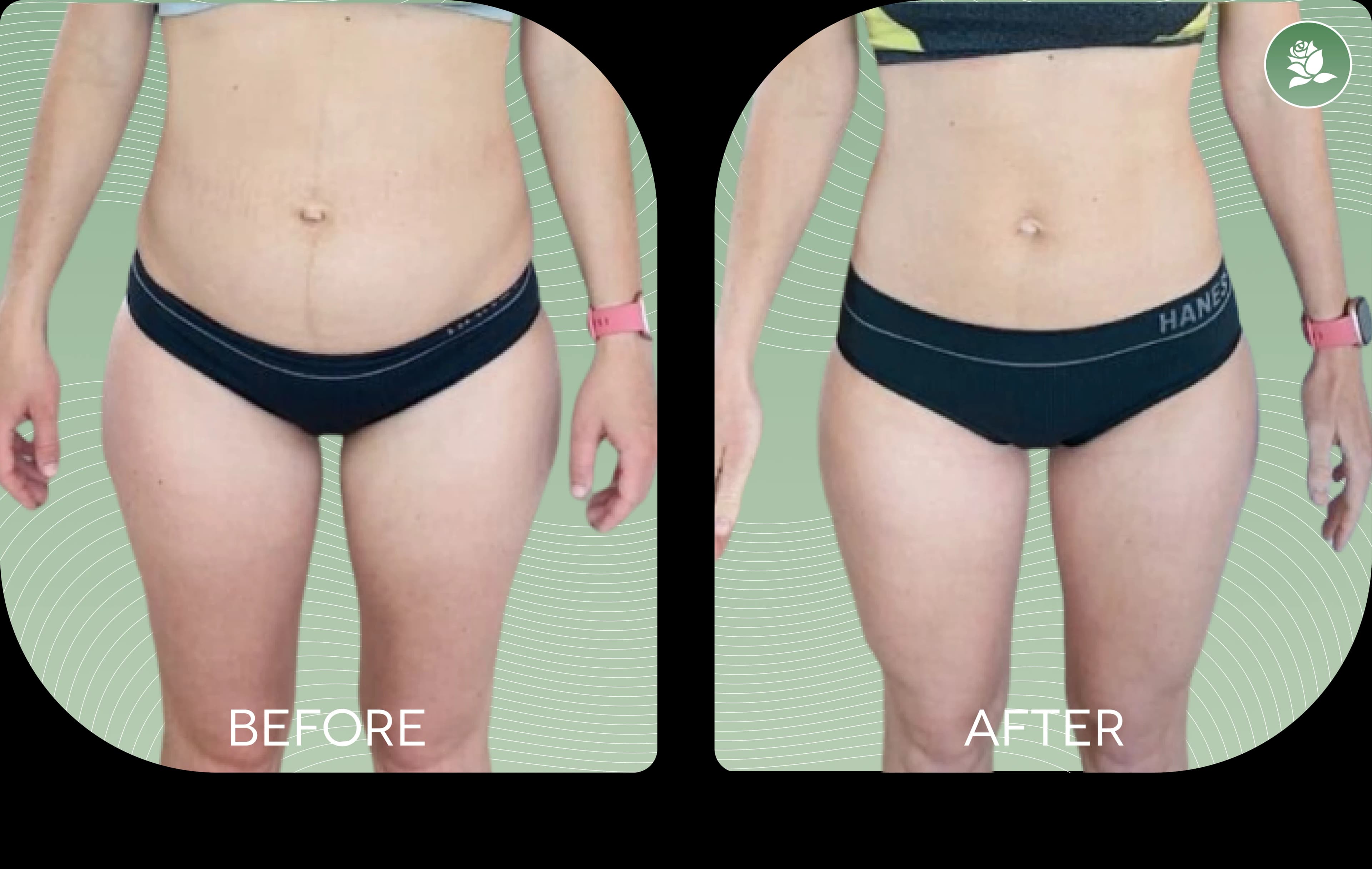 LAURA BENNETT before and after