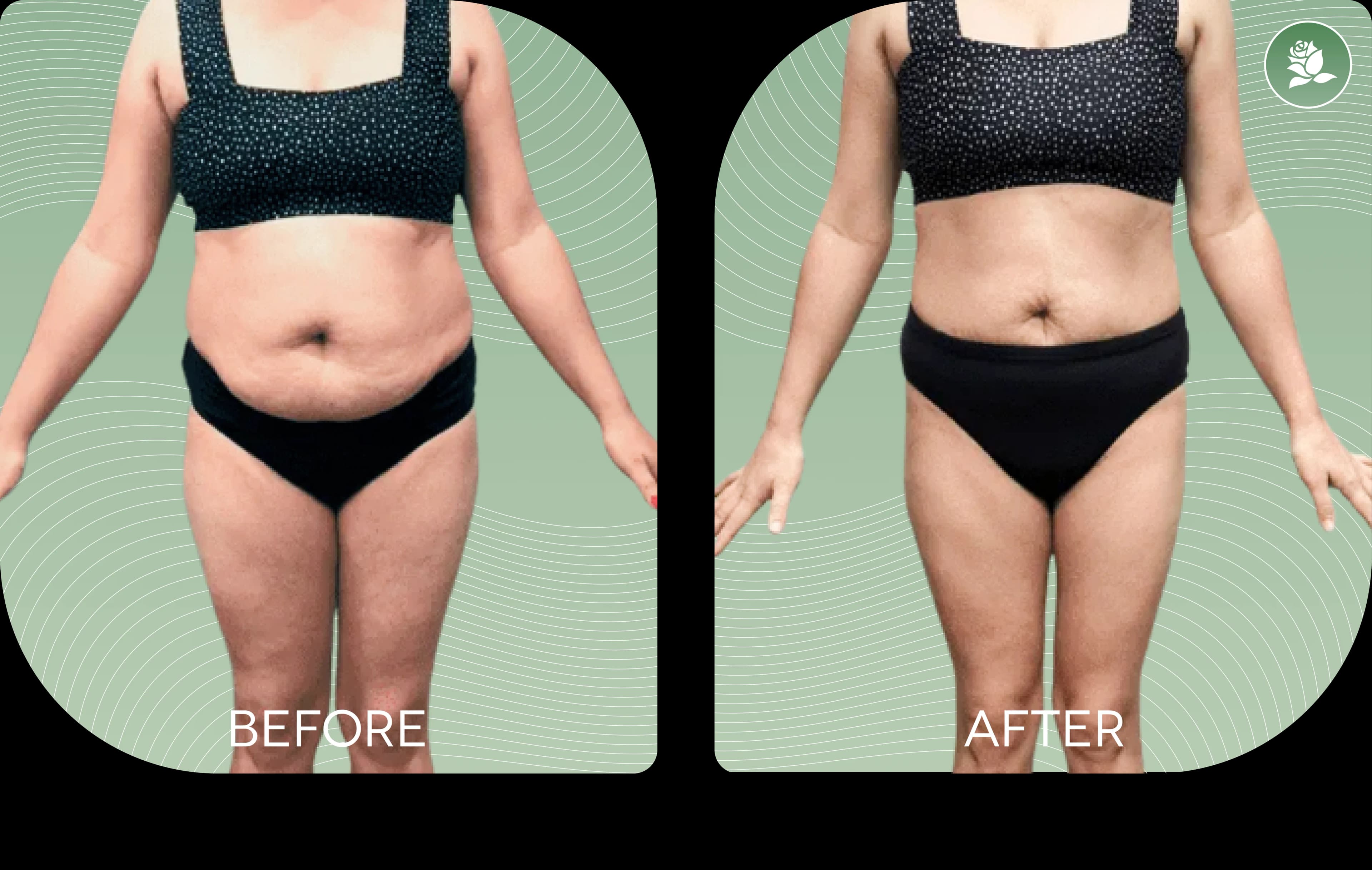 NICOLE FARRUGIA before and after