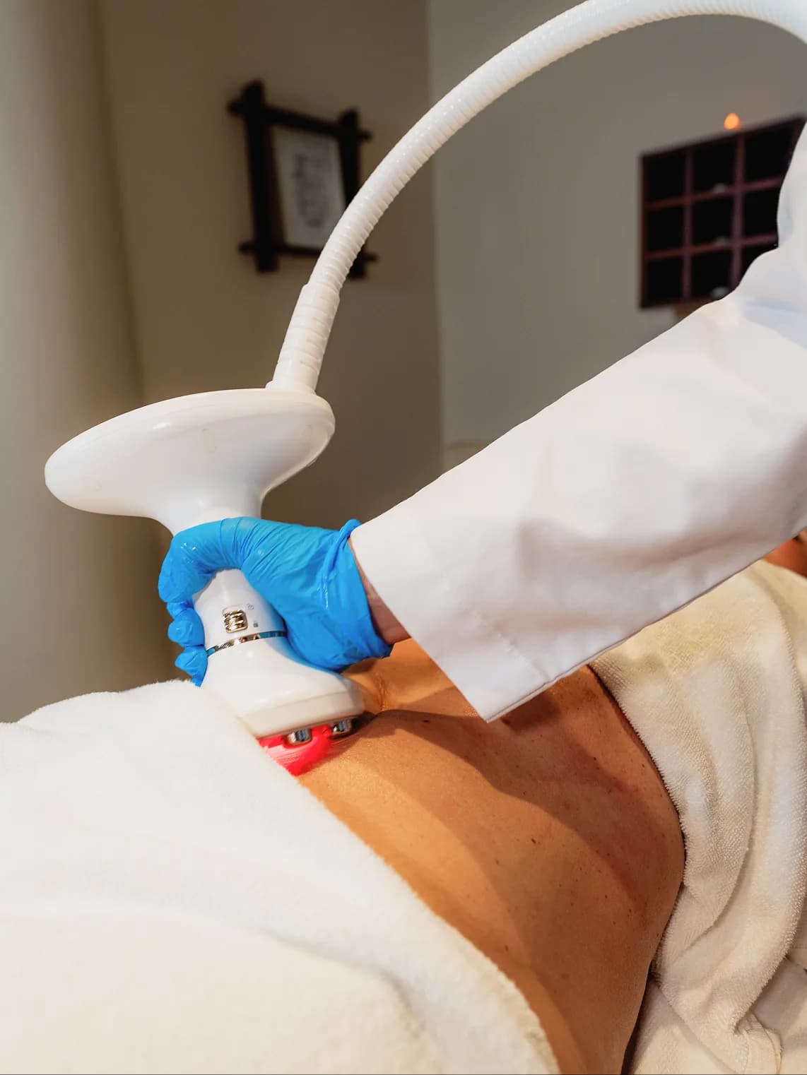 Skin Tightening (VelaShape III)