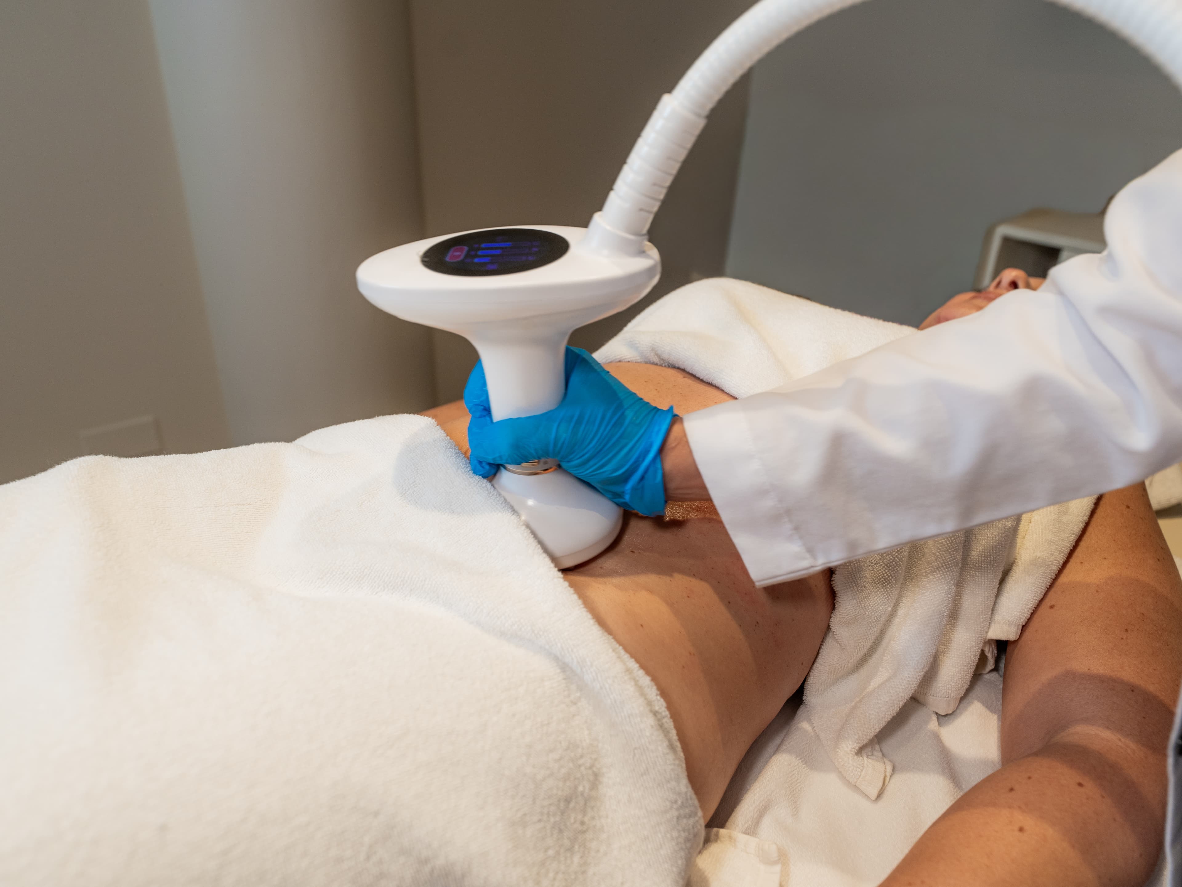 velashape iii treatment at Carisma Slimming, Malta