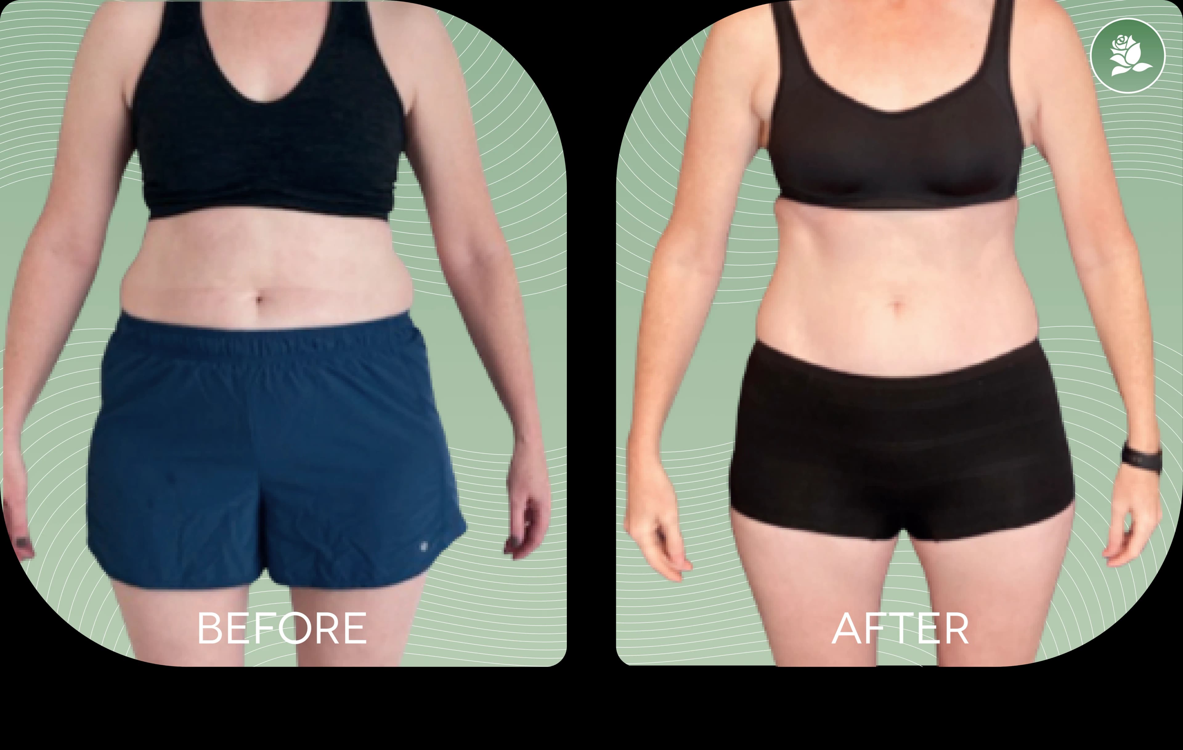 MARY KOWALSKA before and after