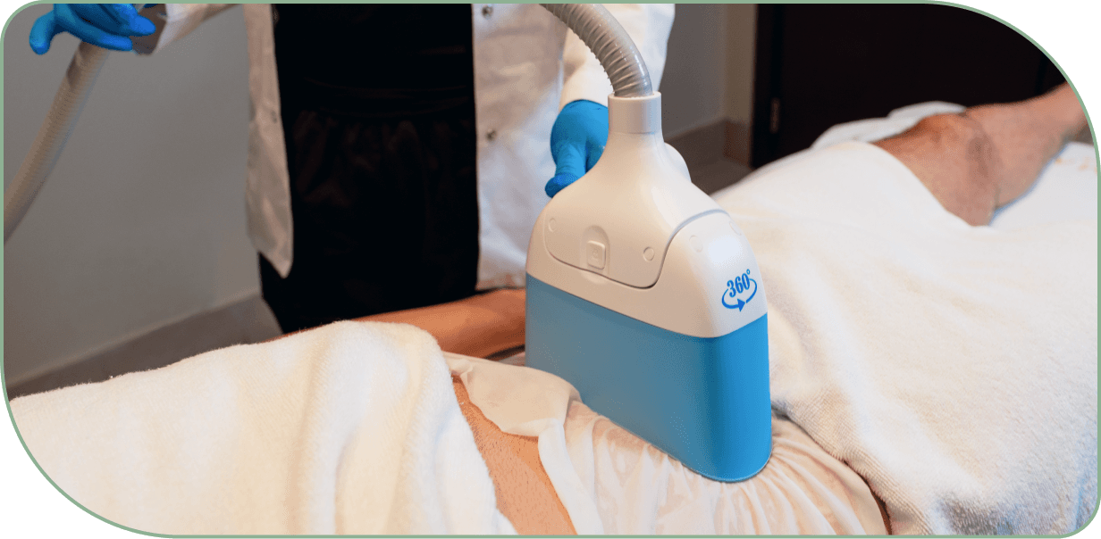 cryolipolysis (coolsculpting fat freezing) evidence illustration