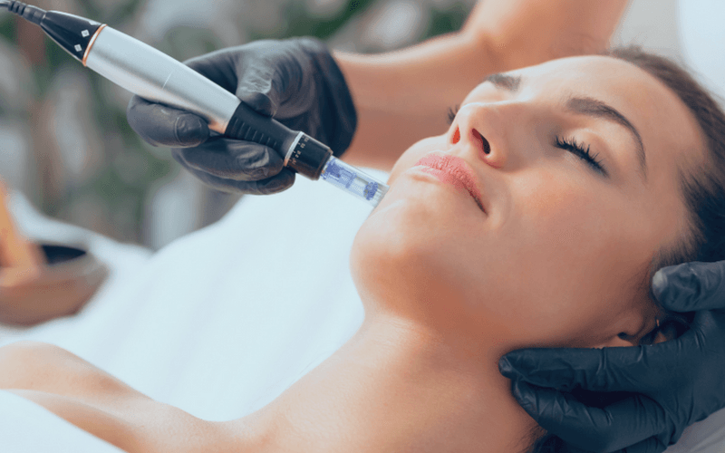 Lift and Tighten: Non-Surgical Skin Tightening Treatments Explained